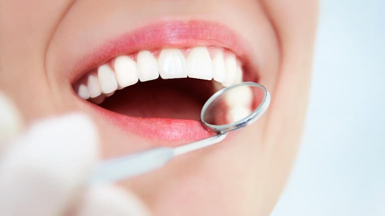 Healthy Living Requires Healthy Gums - Part 2!